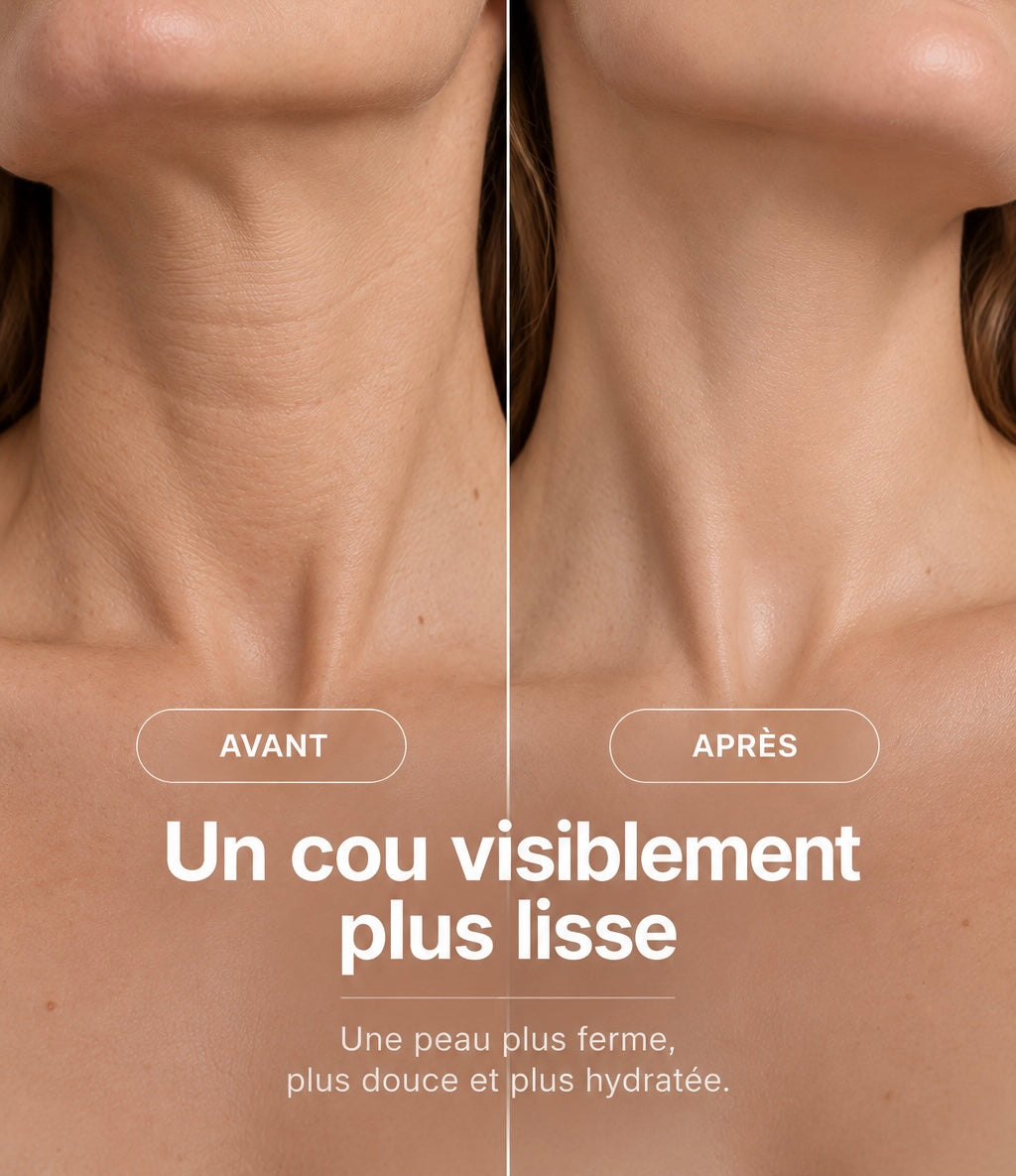 Avant et après : un cou visiblement plus lisse
